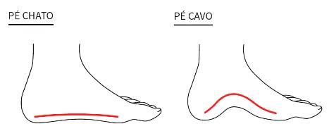 Imagem ilustrativa mostrando a diferença entre o pé chato e o pé cavo.